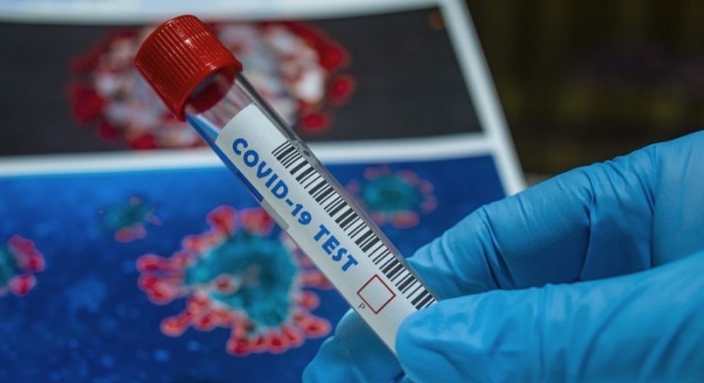 3462 са новите случаи на коронавирус у нас през последното